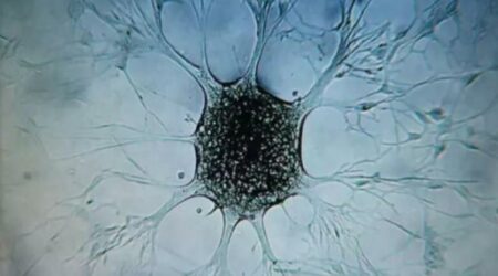 Nueva terapia para frenar el cáncer cerebral